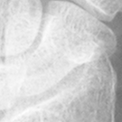 Scaphoid.bmp